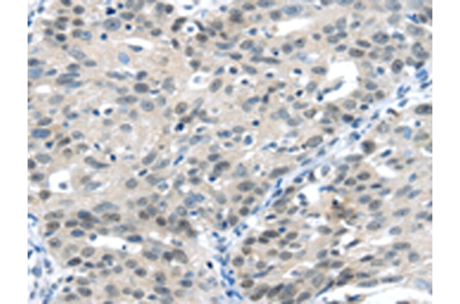 Immunohistochemistry - CCNA1 Antibody from Signalway Antibody (42702) - Antibodies.com