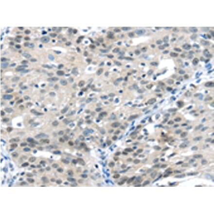 Immunohistochemistry - CCNA1 Antibody from Signalway Antibody (42702) - Antibodies.com