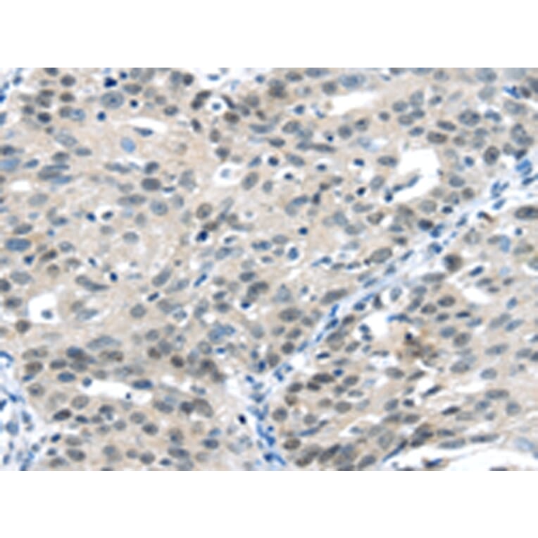 Immunohistochemistry - CCNA1 Antibody from Signalway Antibody (42702) - Antibodies.com