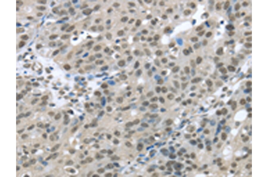 Immunohistochemistry - HDAC1 Antibody from Signalway Antibody (42706) - Antibodies.com