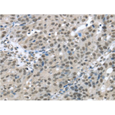 Immunohistochemistry - HDAC1 Antibody from Signalway Antibody (42706) - Antibodies.com
