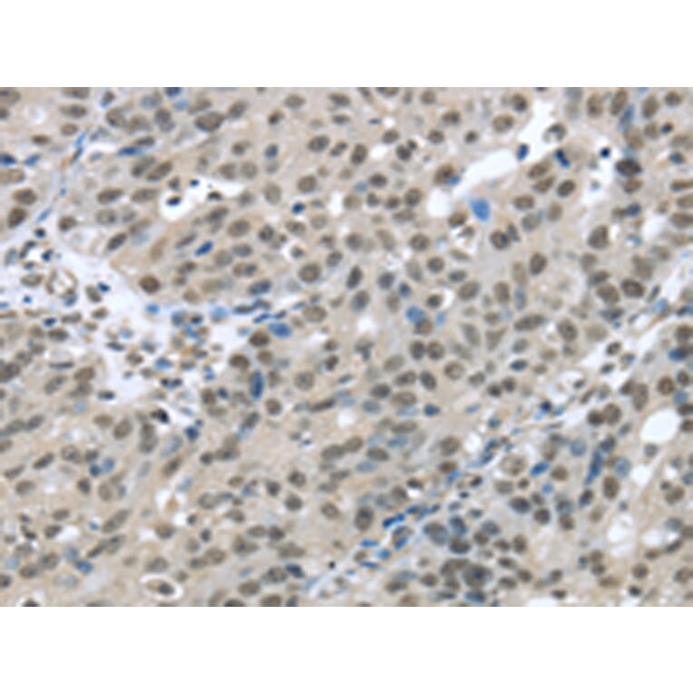 Immunohistochemistry - HDAC1 Antibody from Signalway Antibody (42706) - Antibodies.com