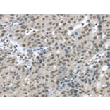 Immunohistochemistry - HDAC1 Antibody from Signalway Antibody (42706) - Antibodies.com