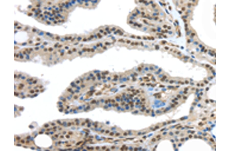 Immunohistochemistry - HDAC1 Antibody from Signalway Antibody (42706) - Antibodies.com