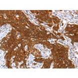 Immunohistochemistry - HOXB1 Antibody from Signalway Antibody (42707) - Antibodies.com