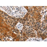 Immunohistochemistry - HOXB1 Antibody from Signalway Antibody (42707) - Antibodies.com
