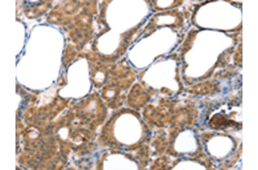 Immunohistochemistry - LAMA4 Antibody from Signalway Antibody (42711) - Antibodies.com