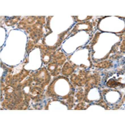 Immunohistochemistry - LAMA4 Antibody from Signalway Antibody (42711) - Antibodies.com