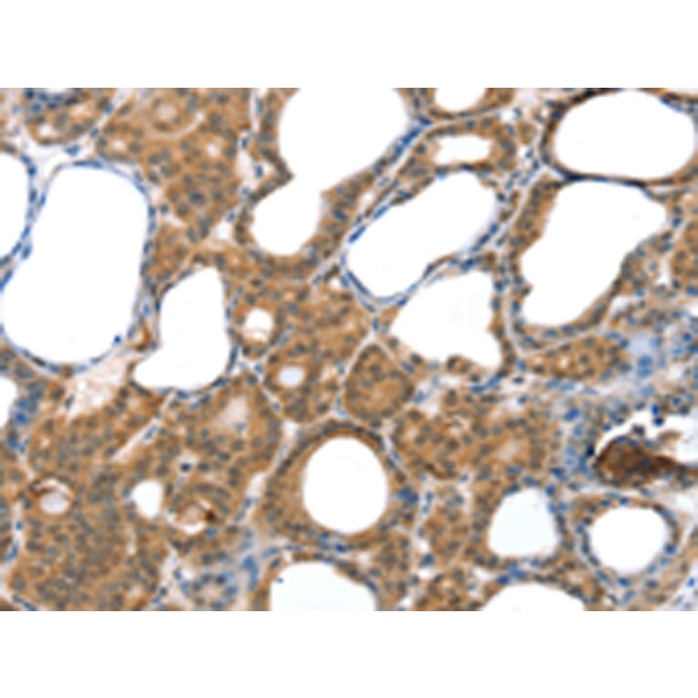 Immunohistochemistry - LAMA4 Antibody from Signalway Antibody (42711) - Antibodies.com