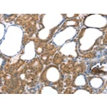 Immunohistochemistry - LAMA4 Antibody from Signalway Antibody (42711) - Antibodies.com