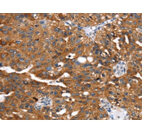 Immunohistochemistry - EGLN1 Antibody from Signalway Antibody (42722) - Antibodies.com