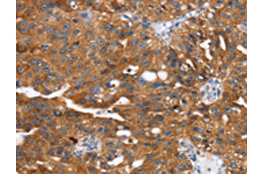 Immunohistochemistry - EGLN1 Antibody from Signalway Antibody (42722) - Antibodies.com