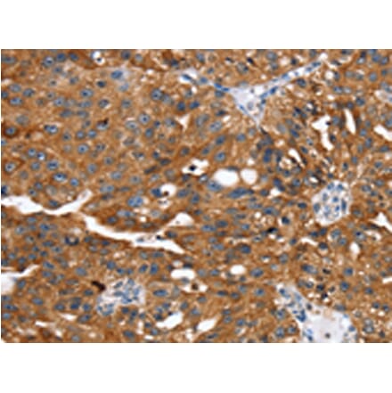 Immunohistochemistry - EGLN1 Antibody from Signalway Antibody (42722) - Antibodies.com