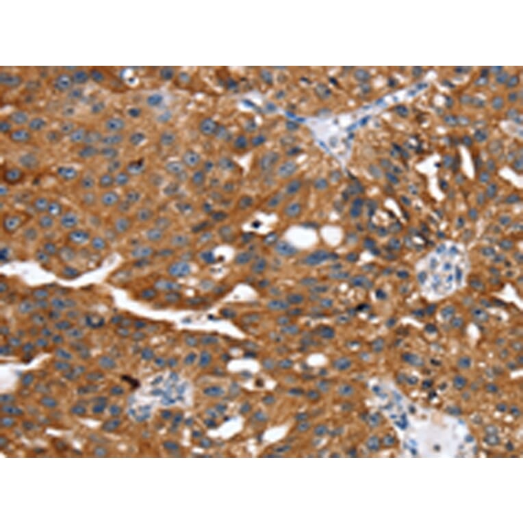 Immunohistochemistry - EGLN1 Antibody from Signalway Antibody (42722) - Antibodies.com