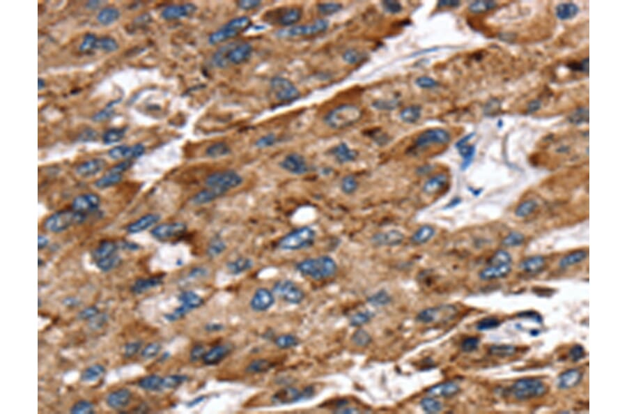 Immunohistochemistry - EGLN1 Antibody from Signalway Antibody (42722) - Antibodies.com
