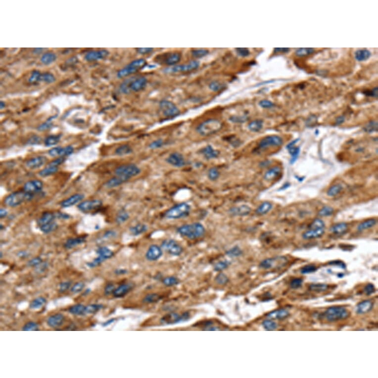 Immunohistochemistry - EGLN1 Antibody from Signalway Antibody (42722) - Antibodies.com