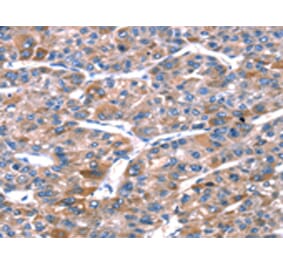 Immunohistochemistry - RPL11 Antibody from Signalway Antibody (42741) - Antibodies.com