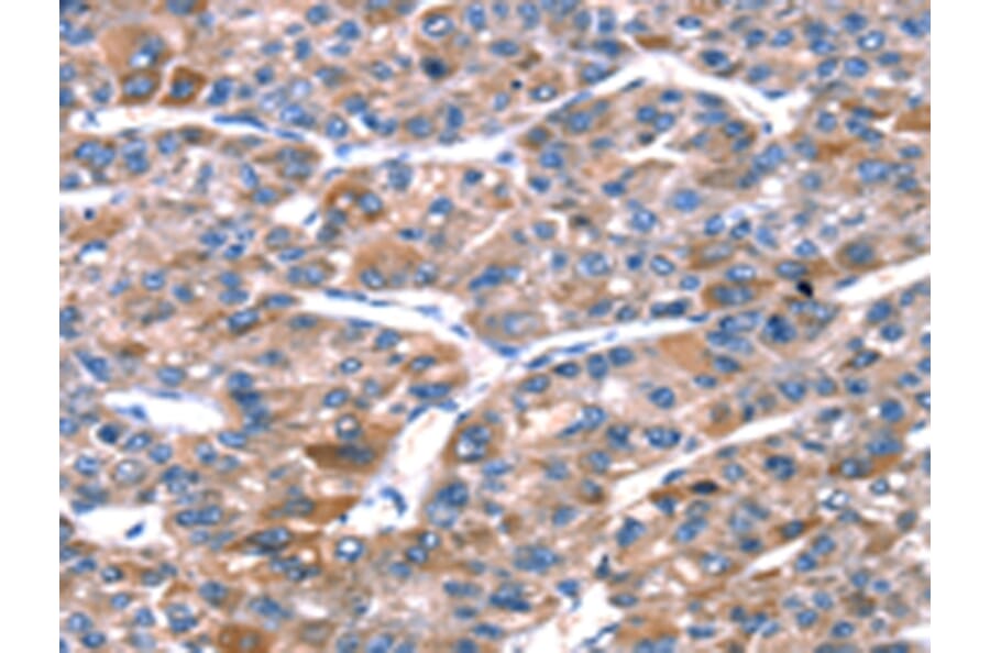 Immunohistochemistry - RPL11 Antibody from Signalway Antibody (42741) - Antibodies.com