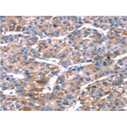Immunohistochemistry - RPL11 Antibody from Signalway Antibody (42741) - Antibodies.com