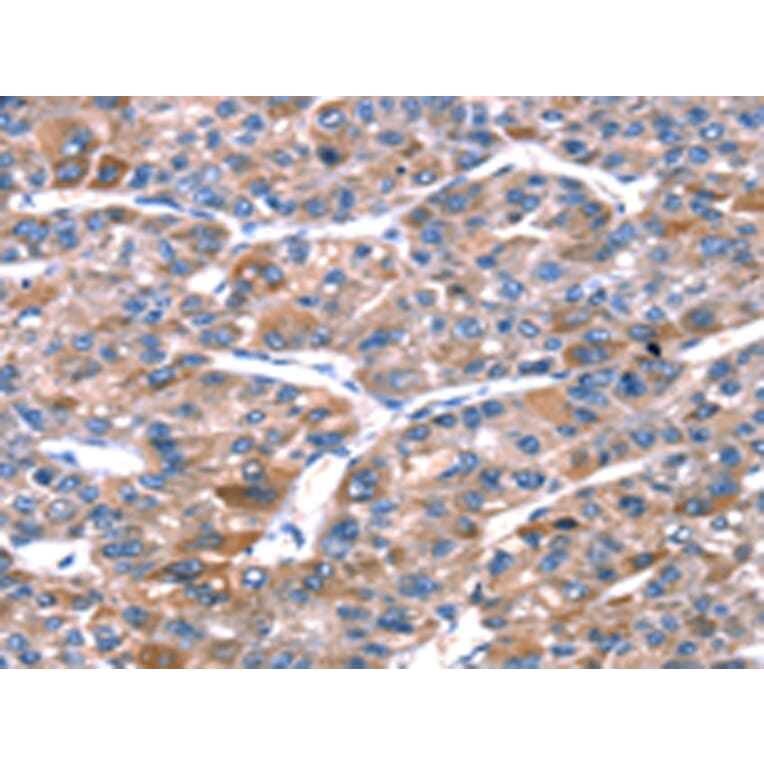 Immunohistochemistry - RPL11 Antibody from Signalway Antibody (42741) - Antibodies.com