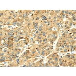 Immunohistochemistry - SENP2 Antibody from Signalway Antibody (42749) - Antibodies.com