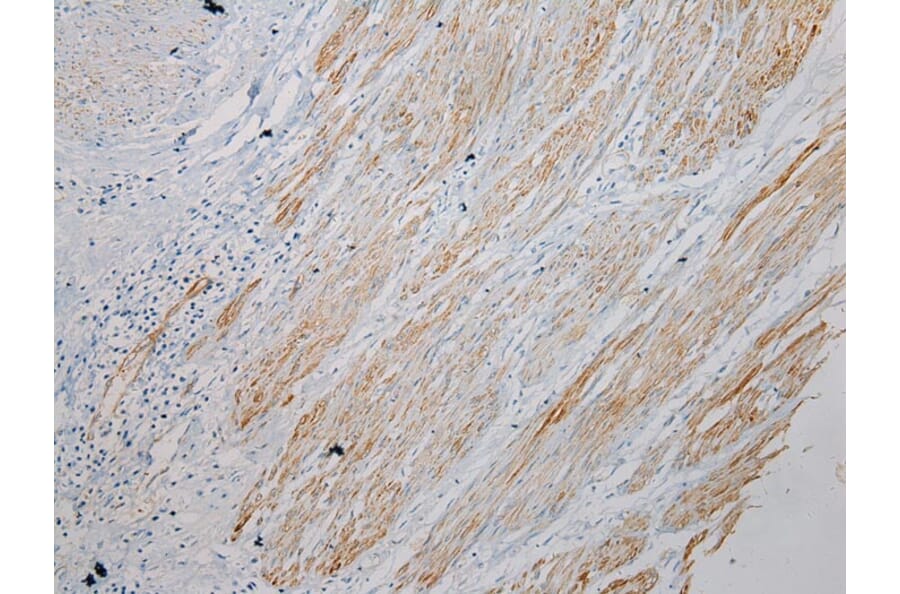Immunohistochemistry - SESN3 Antibody from Signalway Antibody (42754) - Antibodies.com