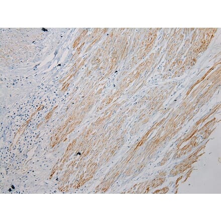 Immunohistochemistry - SESN3 Antibody from Signalway Antibody (42754) - Antibodies.com