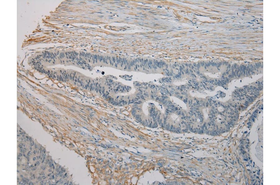 Immunohistochemistry - SESN3 Antibody from Signalway Antibody (42754) - Antibodies.com