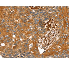 Immunohistochemistry - TAGLN Antibody from Signalway Antibody (42760) - Antibodies.com
