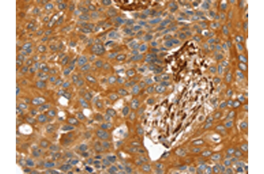 Immunohistochemistry - TAGLN Antibody from Signalway Antibody (42760) - Antibodies.com