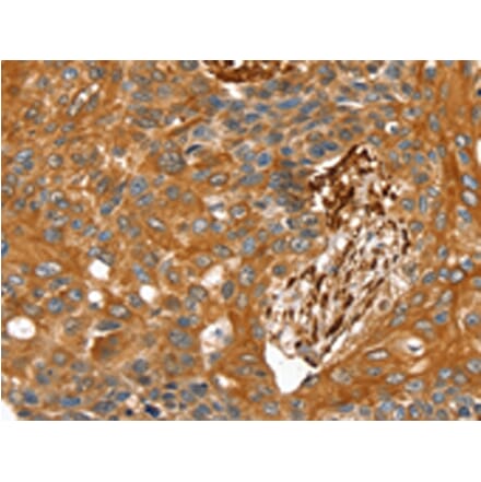 Immunohistochemistry - TAGLN Antibody from Signalway Antibody (42760) - Antibodies.com