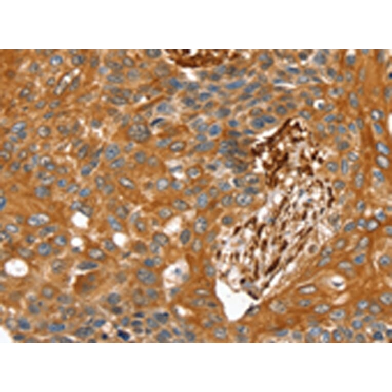Immunohistochemistry - TAGLN Antibody from Signalway Antibody (42760) - Antibodies.com