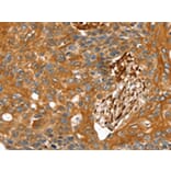 Immunohistochemistry - TAGLN Antibody from Signalway Antibody (42760) - Antibodies.com
