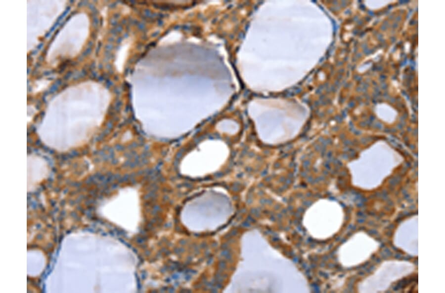Immunohistochemistry - TAGLN Antibody from Signalway Antibody (42760) - Antibodies.com