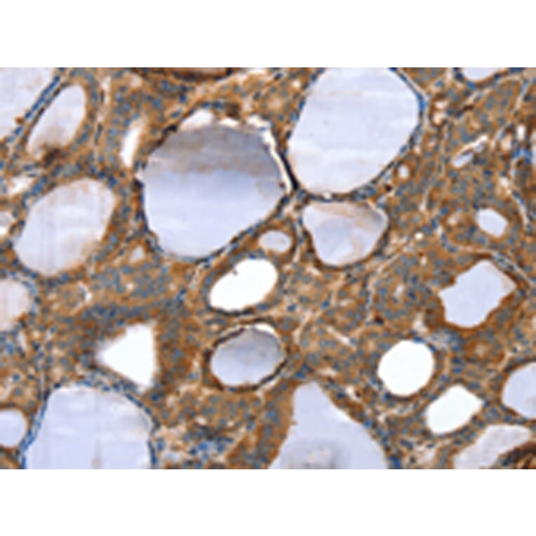 Immunohistochemistry - TAGLN Antibody from Signalway Antibody (42760) - Antibodies.com