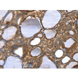 Immunohistochemistry - TAGLN Antibody from Signalway Antibody (42760) - Antibodies.com