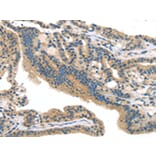 Immunohistochemistry - SMYD3 Antibody from Signalway Antibody (42761) - Antibodies.com