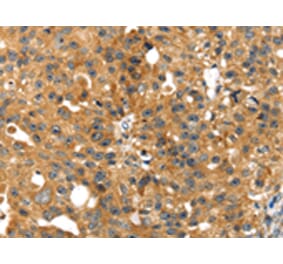 Immunohistochemistry - SMYD4 Antibody from Signalway Antibody (42762) - Antibodies.com