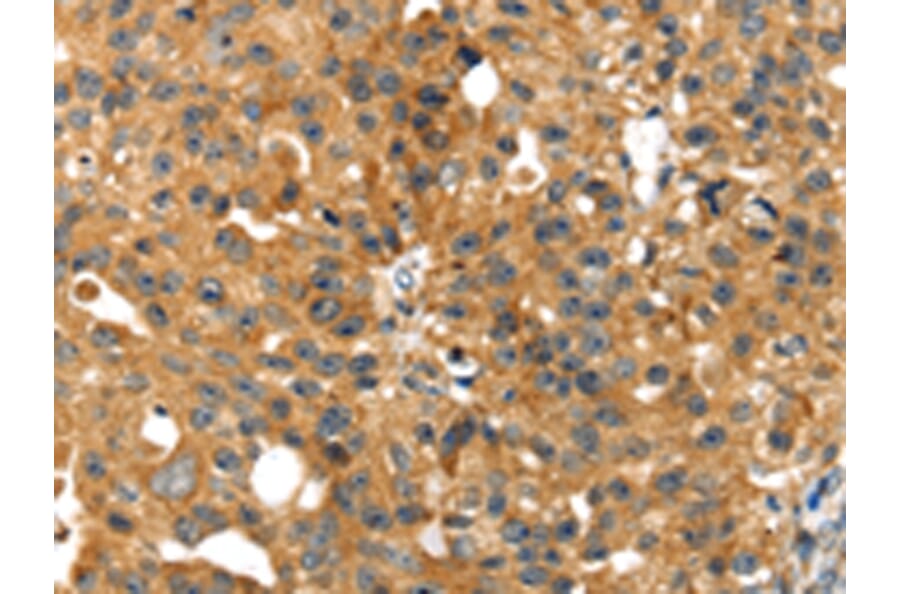 Immunohistochemistry - SMYD4 Antibody from Signalway Antibody (42762) - Antibodies.com