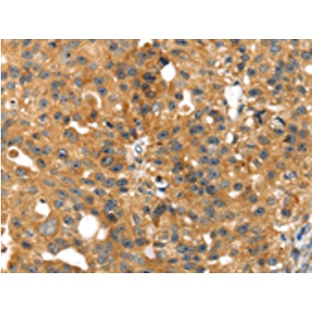 Immunohistochemistry - SMYD4 Antibody from Signalway Antibody (42762) - Antibodies.com