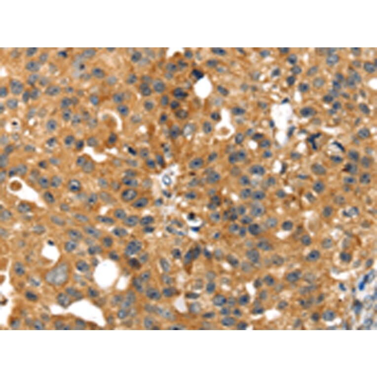 Immunohistochemistry - SMYD4 Antibody from Signalway Antibody (42762) - Antibodies.com