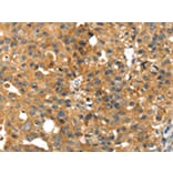Immunohistochemistry - SMYD4 Antibody from Signalway Antibody (42762) - Antibodies.com