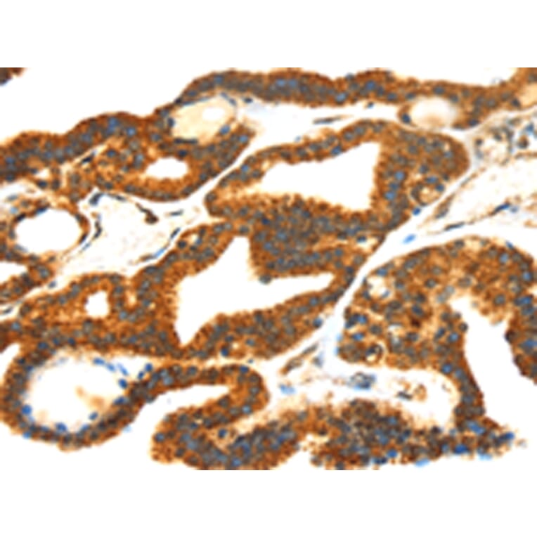 Immunohistochemistry - SMYD4 Antibody from Signalway Antibody (42762) - Antibodies.com