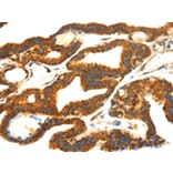 Immunohistochemistry - SMYD4 Antibody from Signalway Antibody (42762) - Antibodies.com