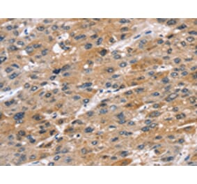 Immunohistochemistry - STK33 Antibody from Signalway Antibody (42768) - Antibodies.com