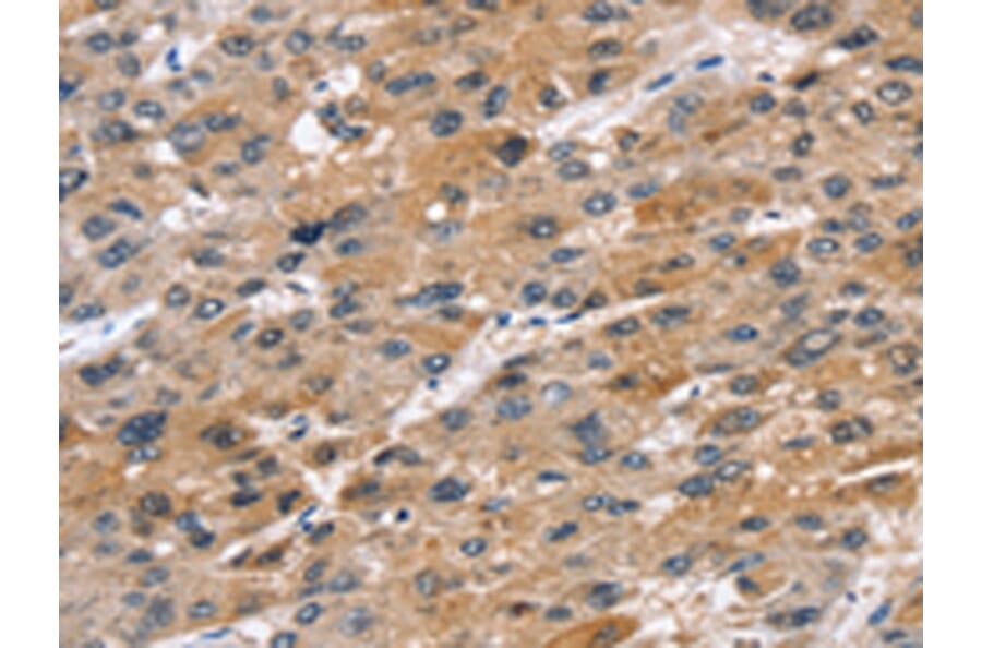 Immunohistochemistry - STK33 Antibody from Signalway Antibody (42768) - Antibodies.com