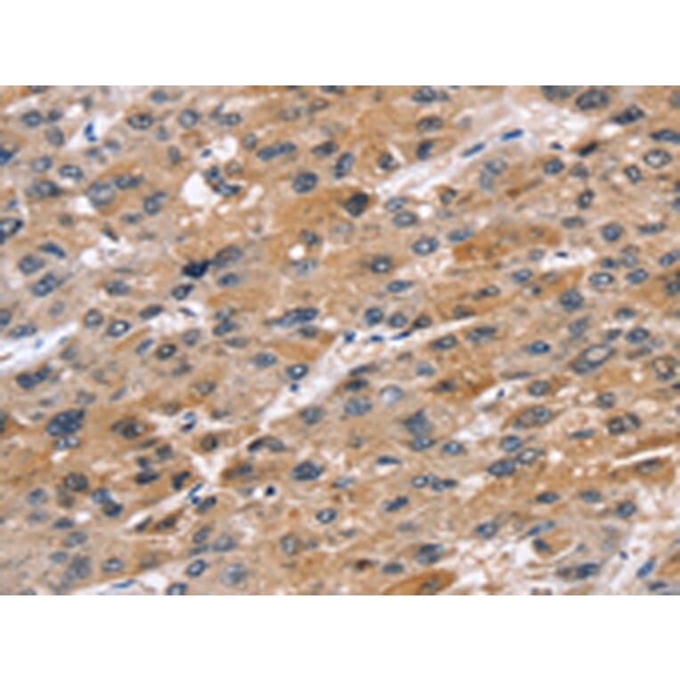 Immunohistochemistry - STK33 Antibody from Signalway Antibody (42768) - Antibodies.com