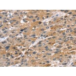 Immunohistochemistry - STK33 Antibody from Signalway Antibody (42768) - Antibodies.com