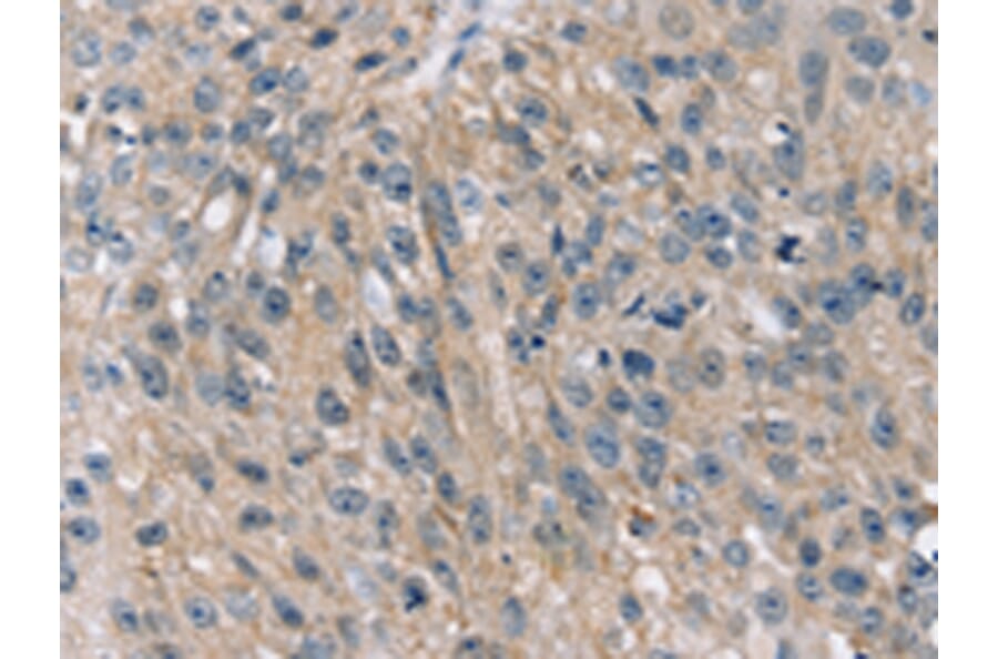 Immunohistochemistry - STK33 Antibody from Signalway Antibody (42768) - Antibodies.com