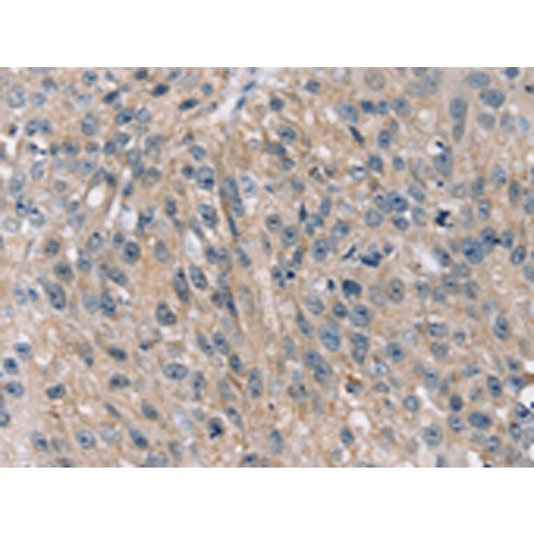 Immunohistochemistry - STK33 Antibody from Signalway Antibody (42768) - Antibodies.com